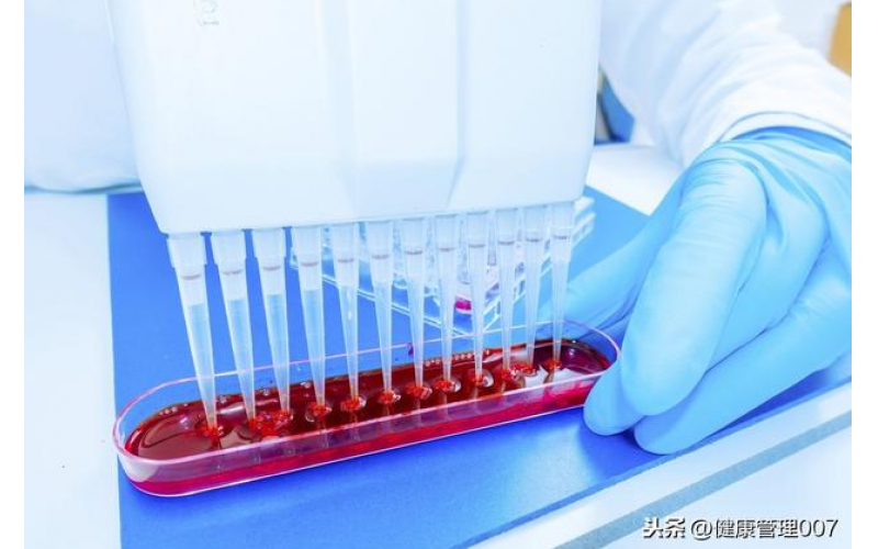 上?？諝鈾z測項目清單及費用